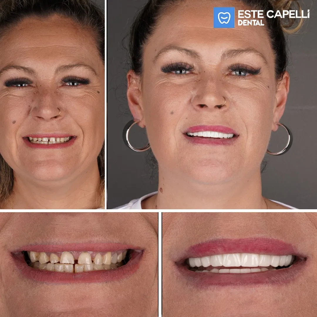 Before and after result