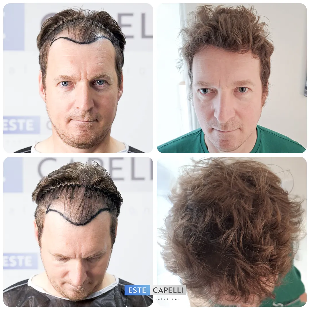 Before and after result