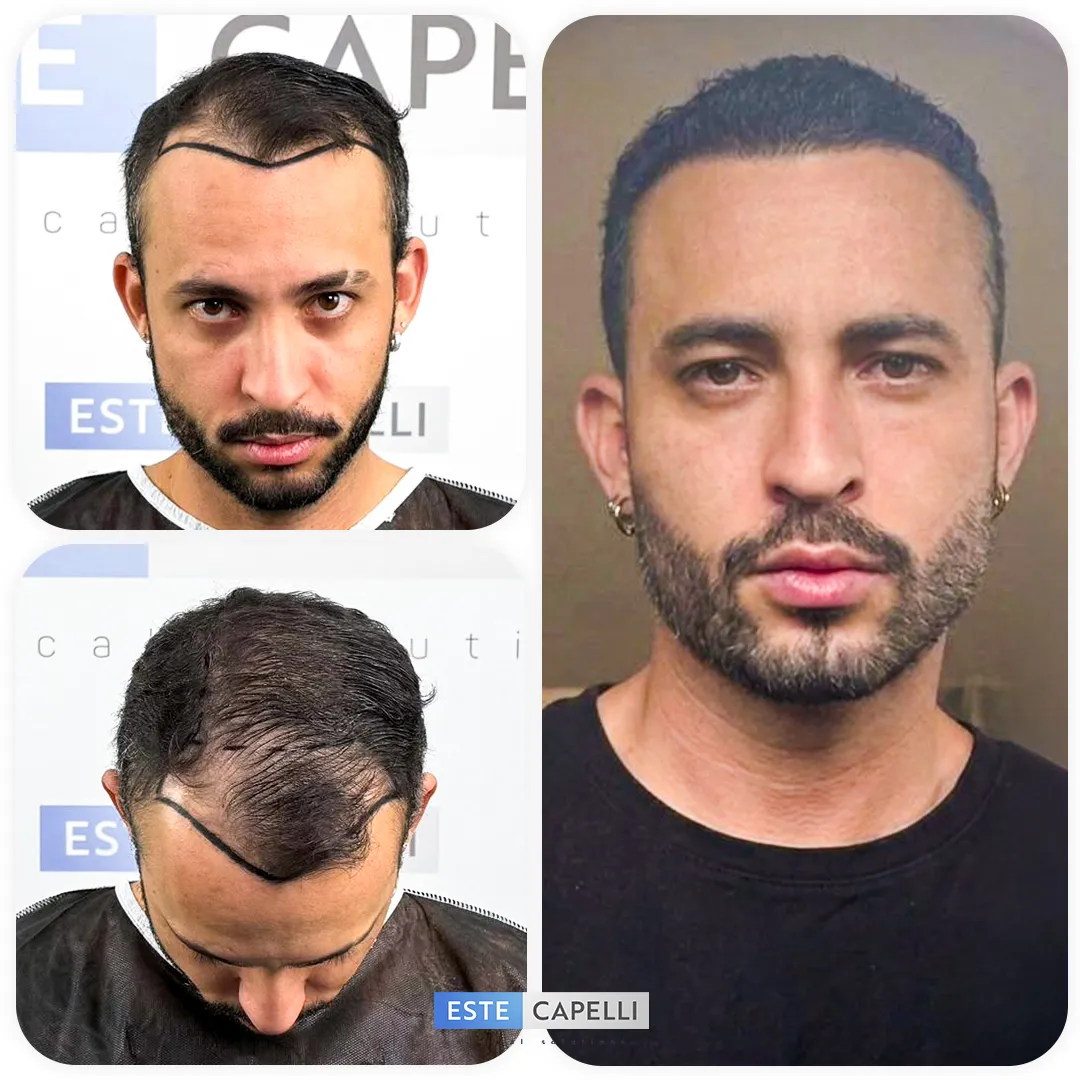 Before and after result