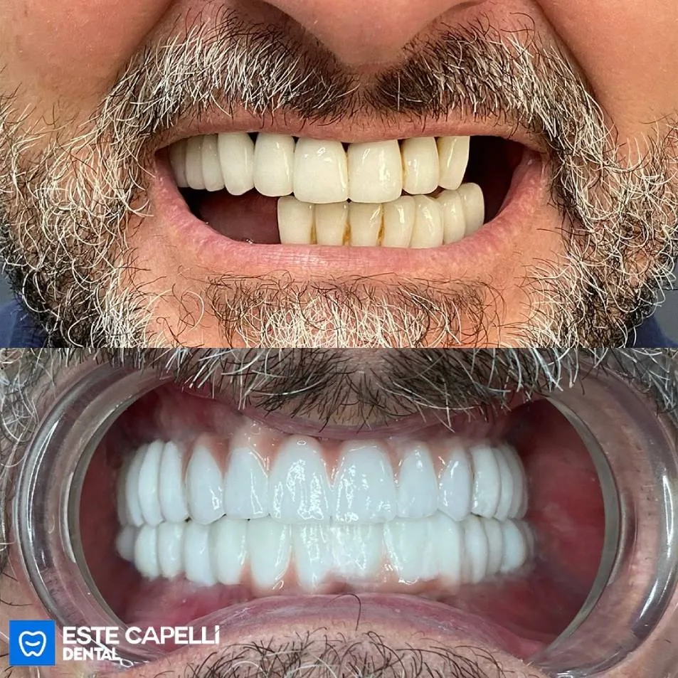 Before and after result