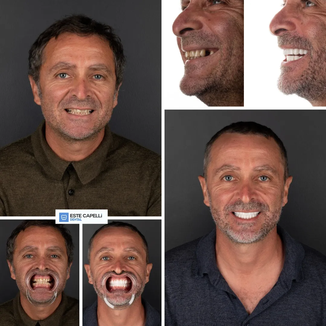 Before and after result