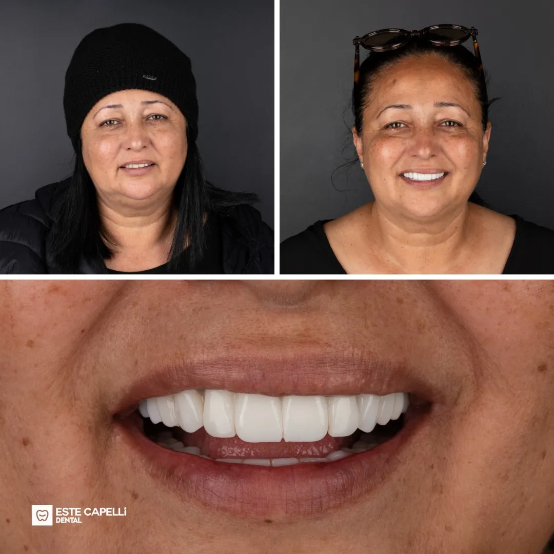 Before and after result