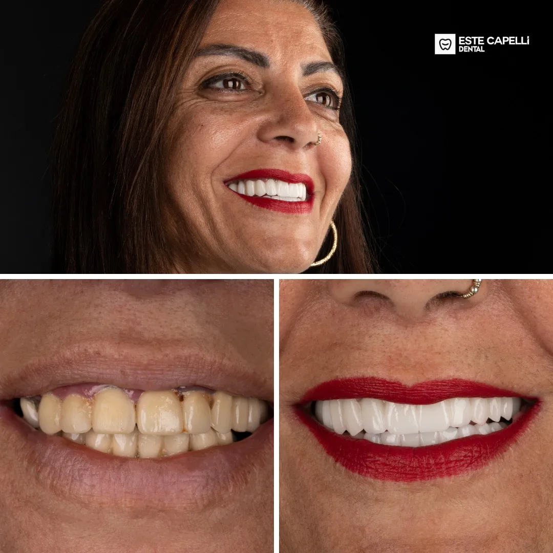 Before and after result