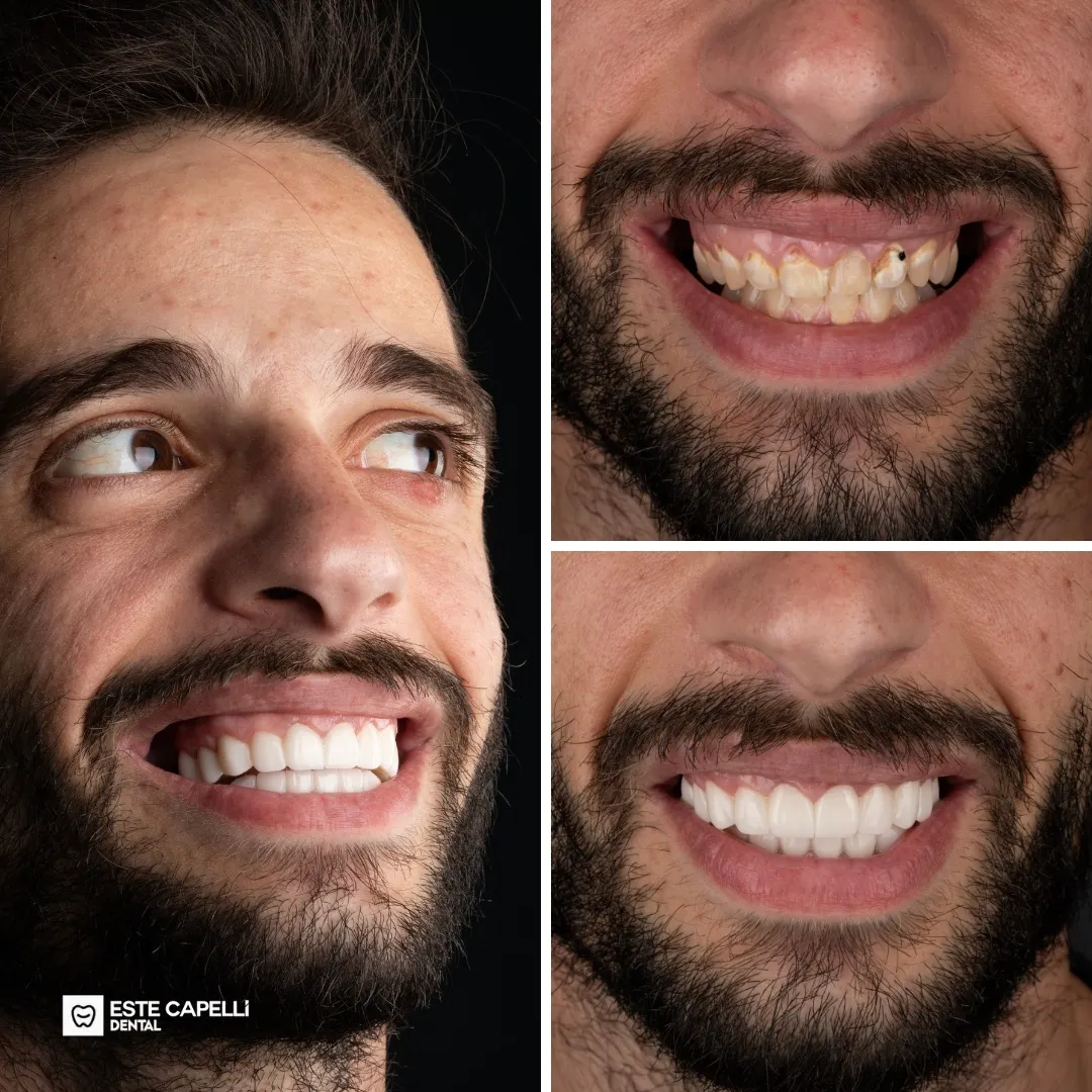 Before and after result