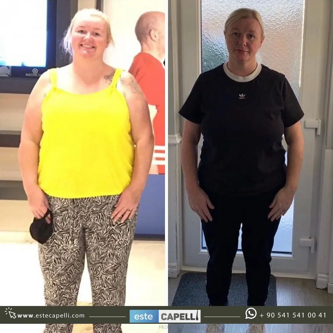 Before and after result