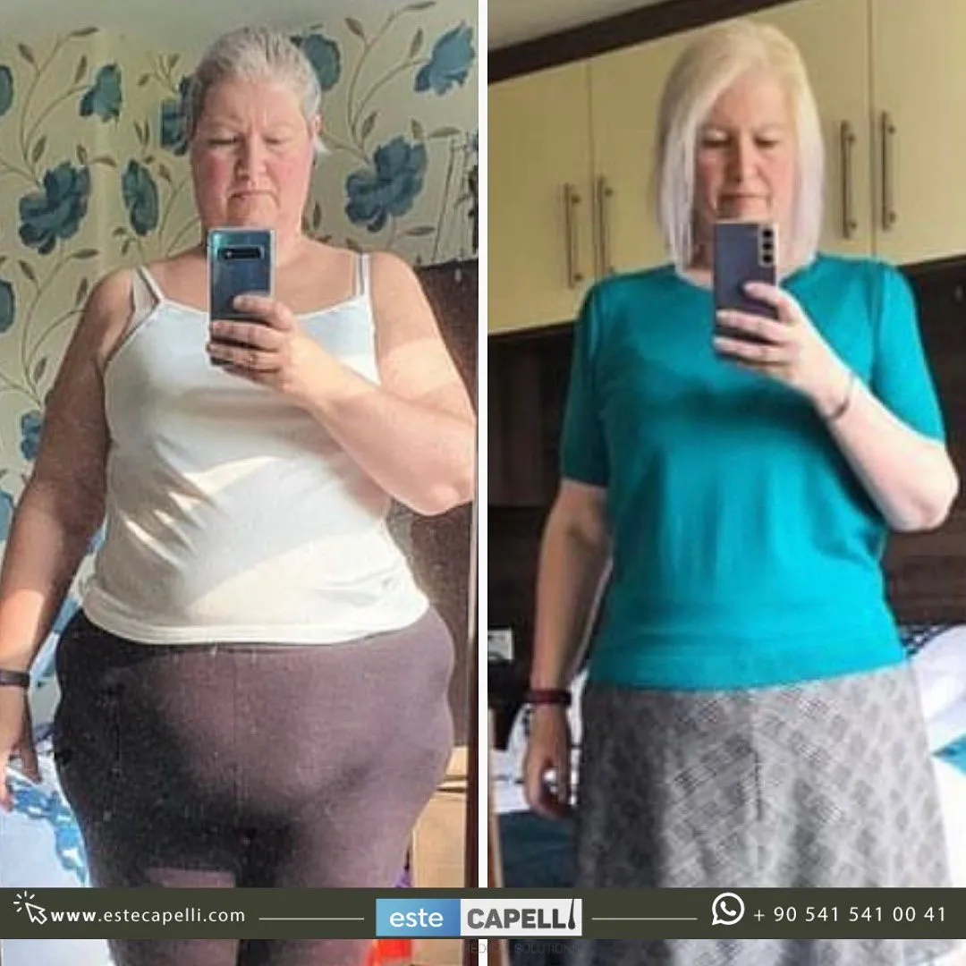 Before and after result