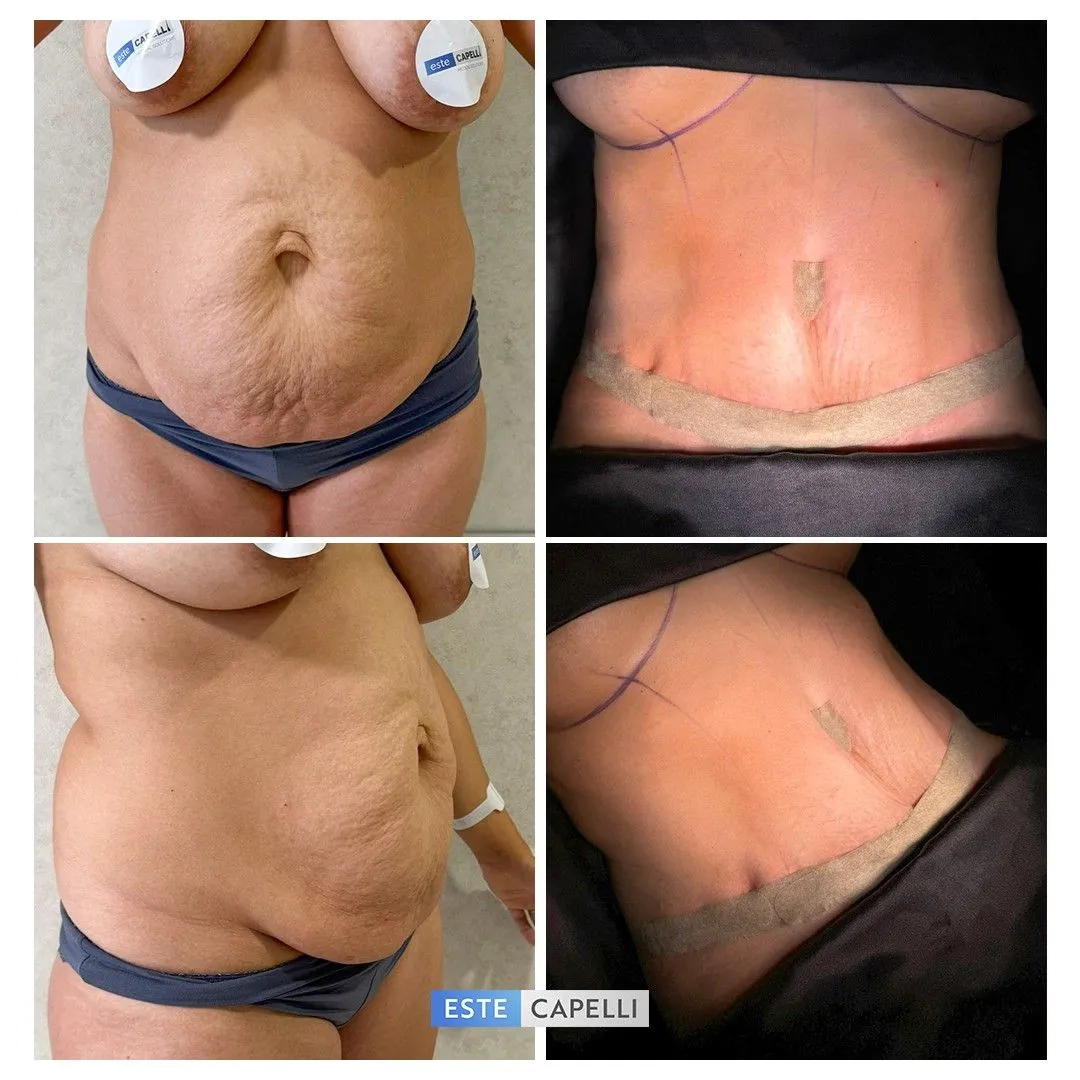 Before and after result