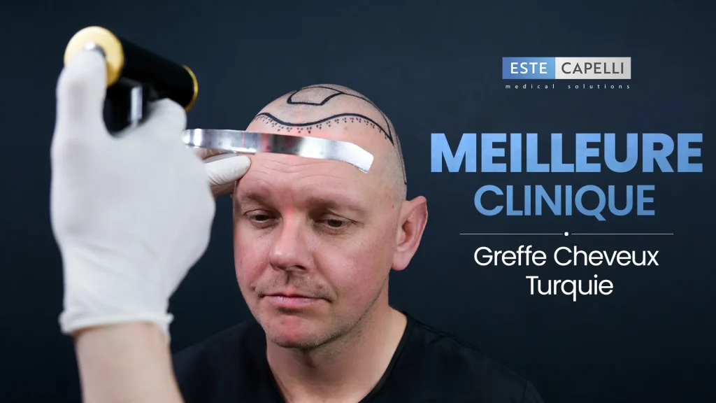 Meilleure clinique greffe cheveux Turquie – salle d'opération EsteCapelli à Istanbul