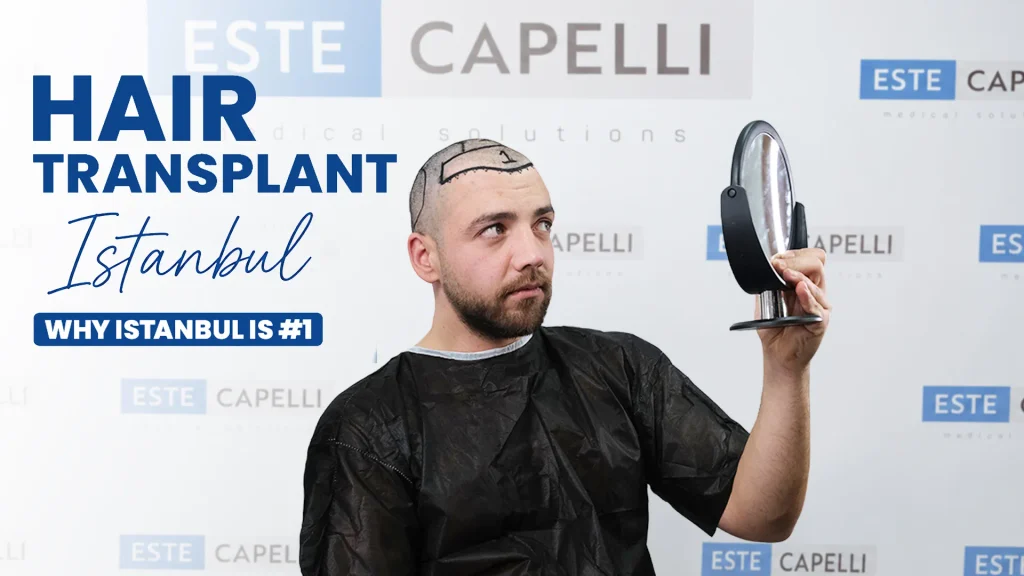 surgeon planning a hair transplant in Istanbul