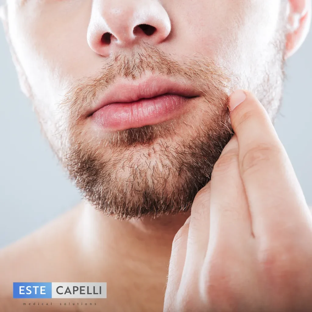 Hombre con barba irregular revisa las zonas con poco vello que quiere rellenar